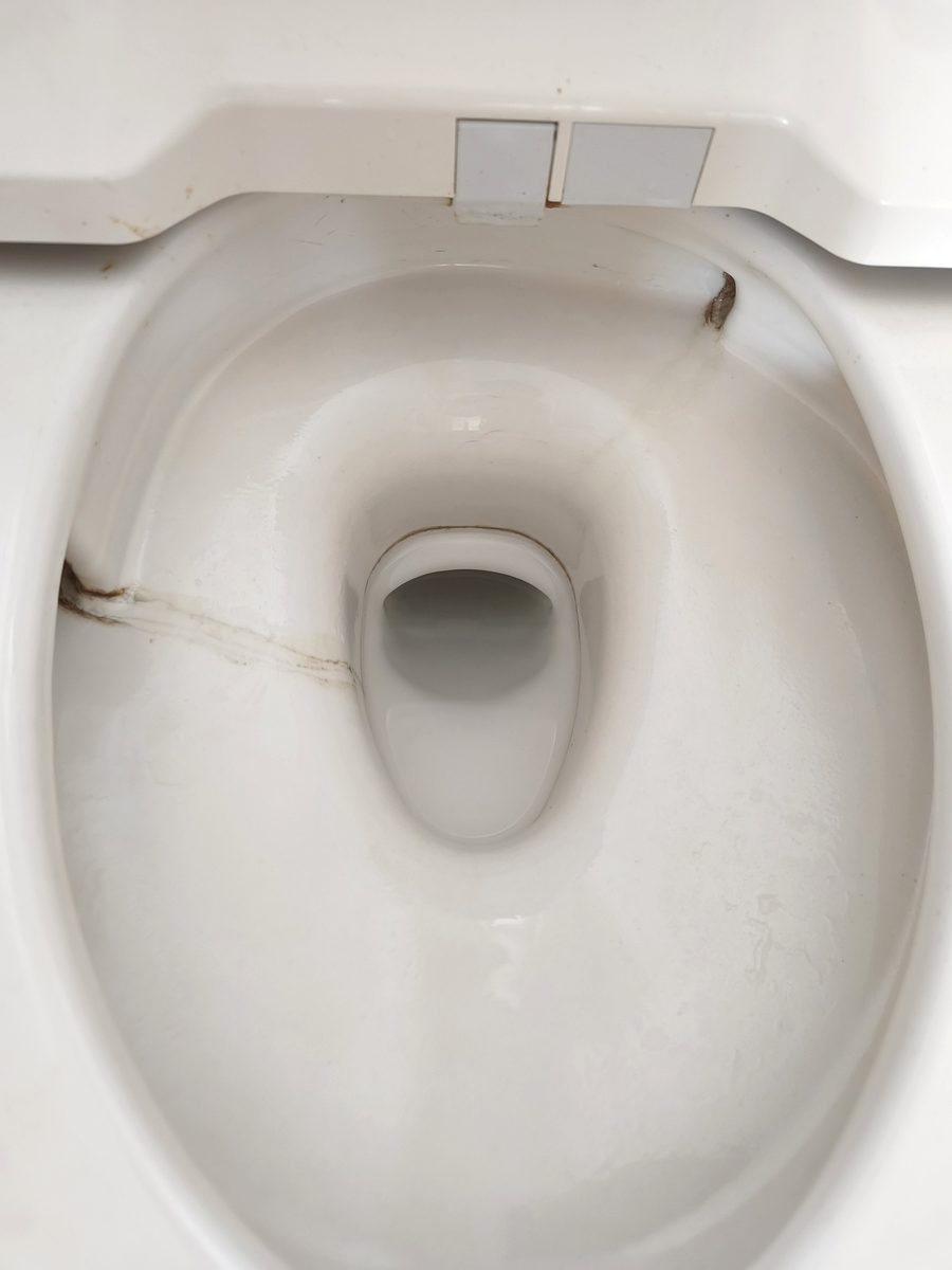 トイレ便器の黒ずみ（掃除前）